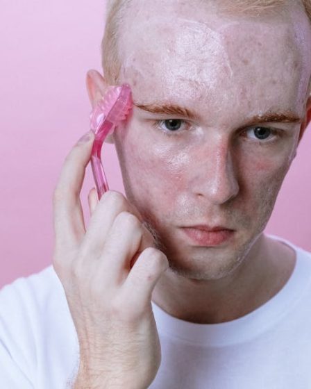 Stop letting TikTok ruin your daughter’s face: The real talk on teen acne