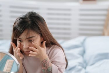Fungal Acne Routine: 7 Signs You Have Fungal Acne and the Routine That Clears It