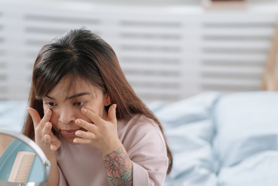 Fungal Acne Routine: 7 Signs You Have Fungal Acne and the Routine That Clears It
