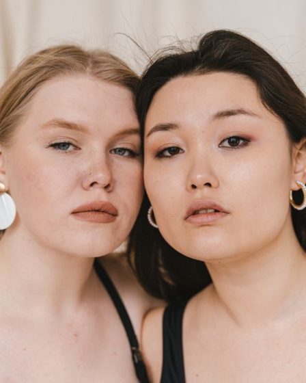 Hormonal Chin Acne Treatment: Why Your Chin Acne Keeps Coming Back (And How to Fix It)