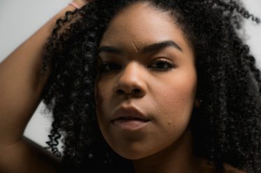 Hormonal Chin Acne Without Prescription Meds: Hormonal Chin Acne: How I Cleared It Without Prescription Meds