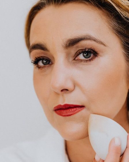 Hormonal Chin Acne Without Prescription Meds: What Worked for Me